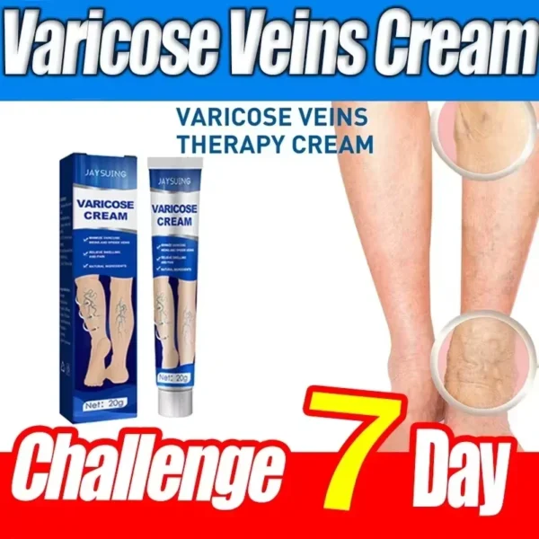 Ointment for Elimination of Varicose Veins and Relieve Spider Veins Herbal cream